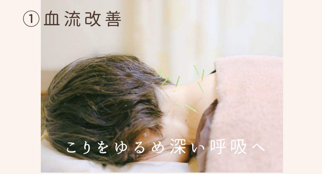 血流改善の鍼