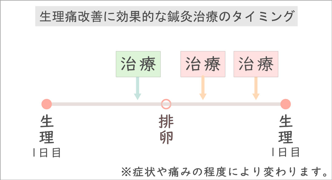 生理痛の鍼治療の時期