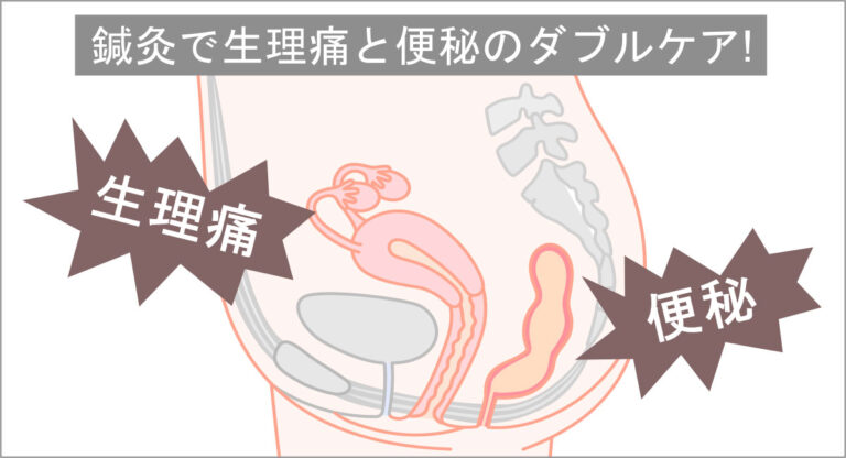 生理痛と便秘のダブルケア！鍼灸治療の効果とは