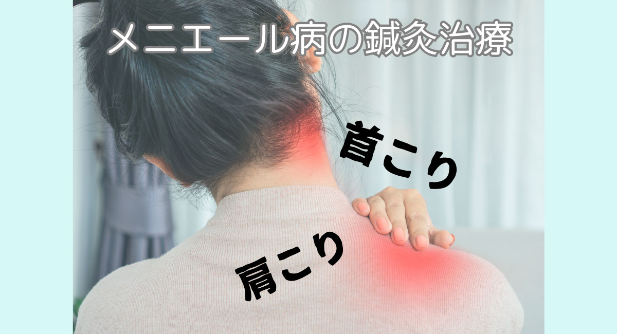 【メニエール病改善】鍼灸で内耳水液循環を整える効果的な治療法と症例解説