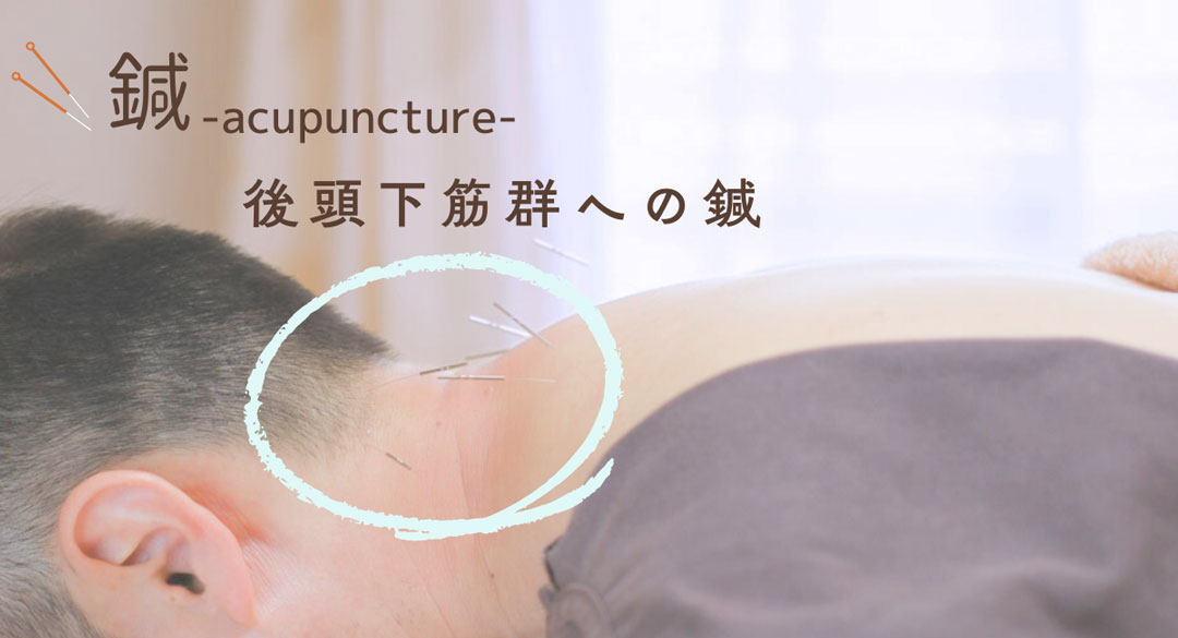 後頭下筋群へ鍼