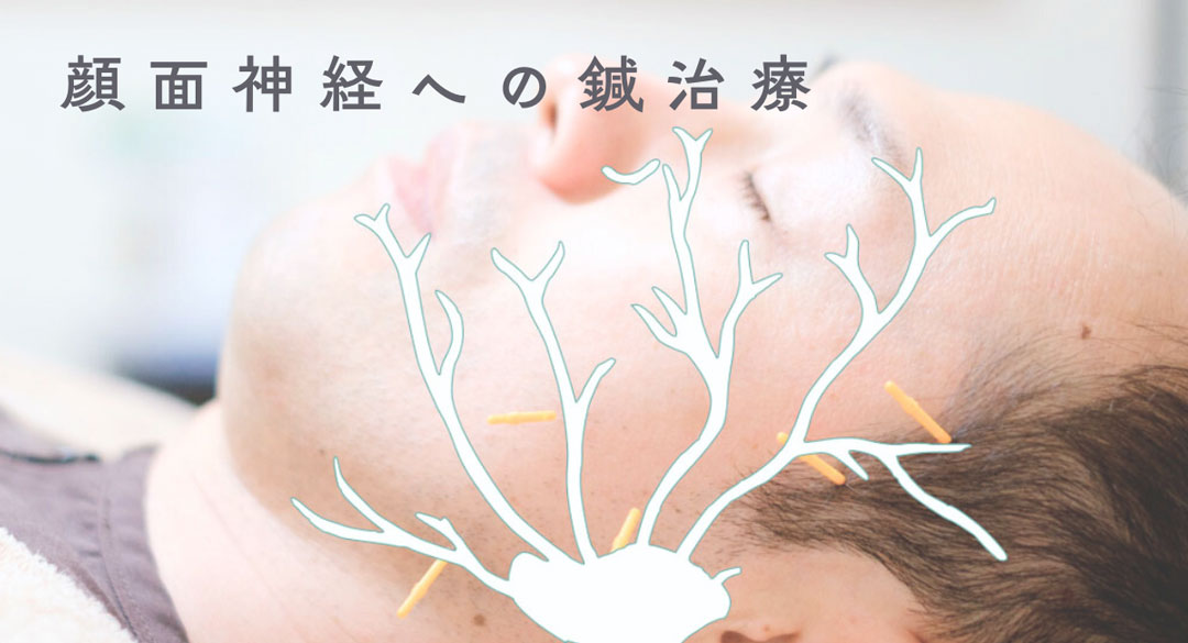 顔面神経麻痺の位置