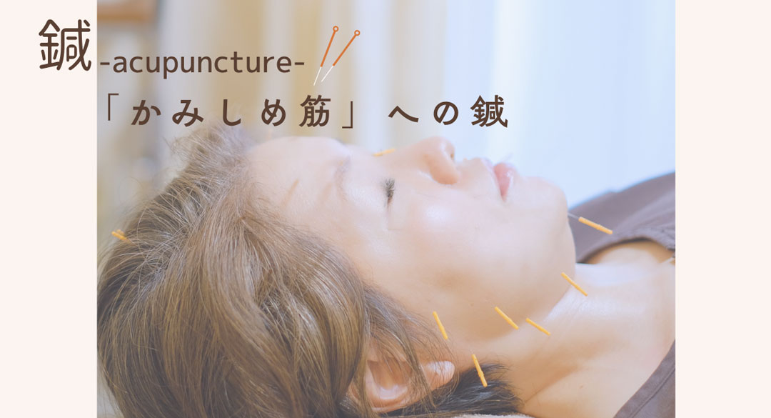 かみしめ筋に鍼