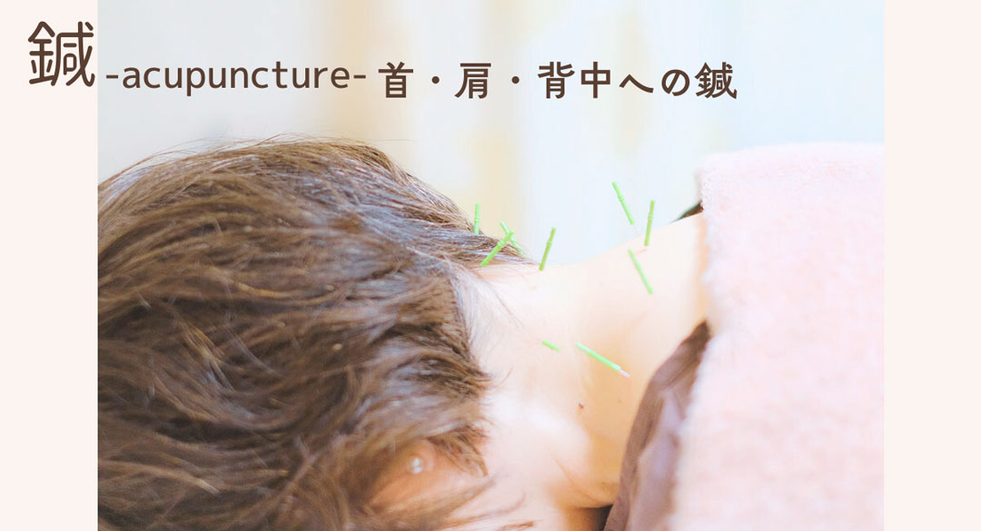 首のコリに鍼