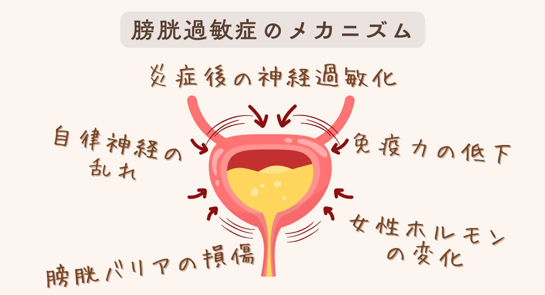 膀胱過敏症の仕組み