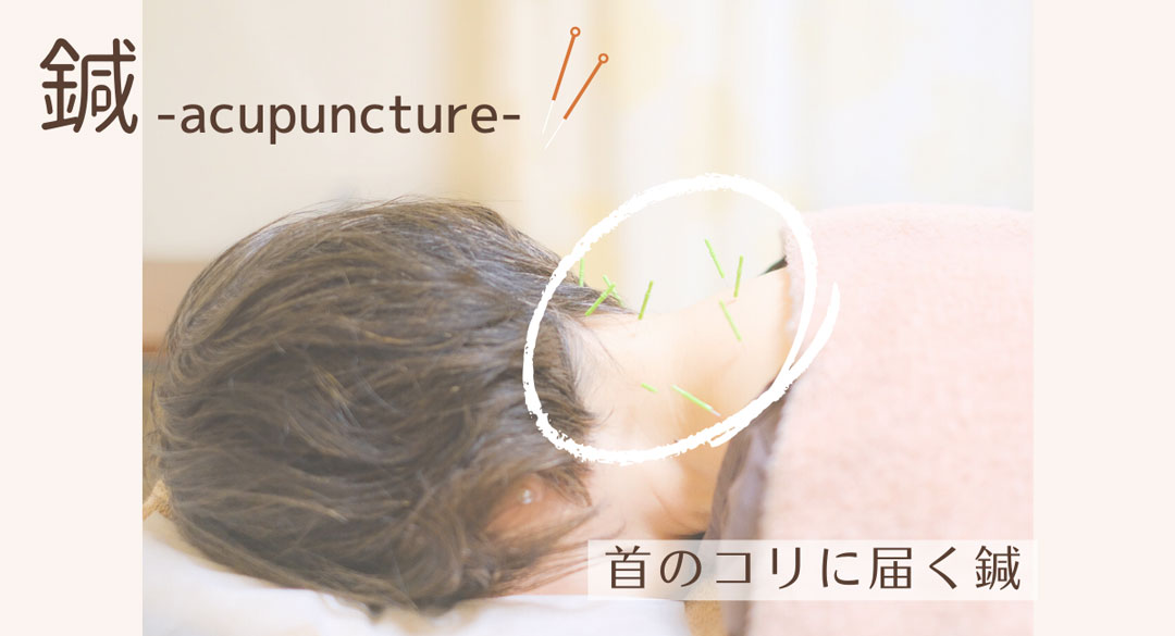 首コリに効く鍼