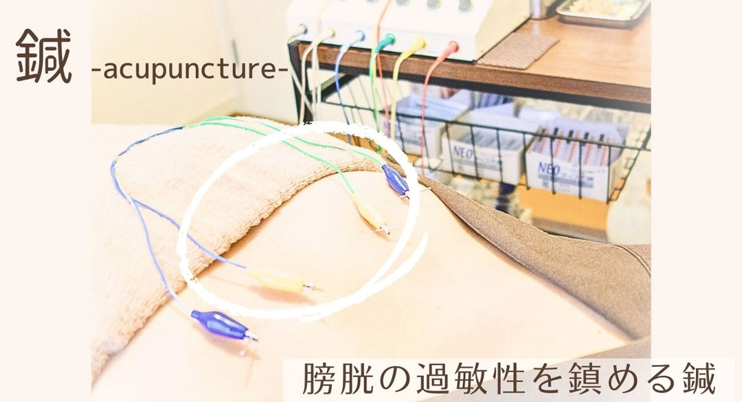 膀胱炎の鍼灸治療