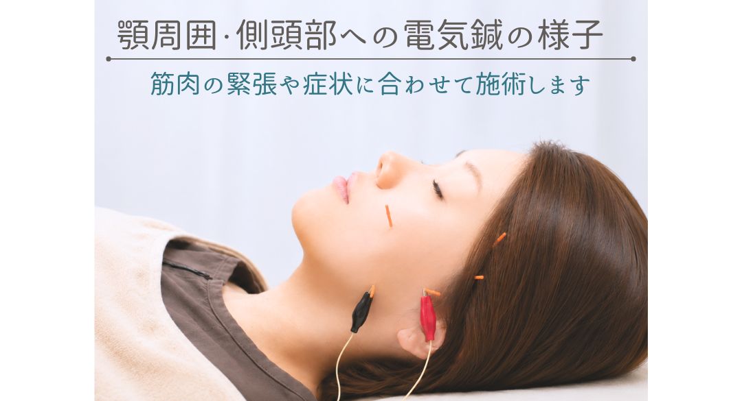 顎と側頭部へ電気鍼