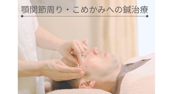 こめかみに鍼治療